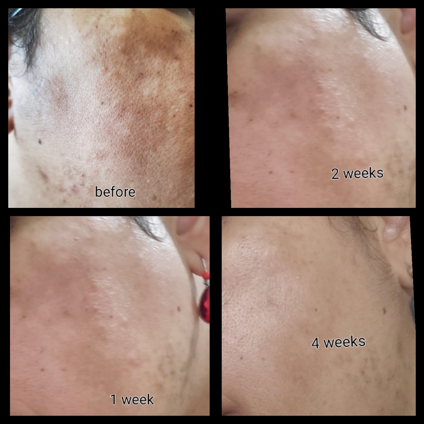 Healing Clay